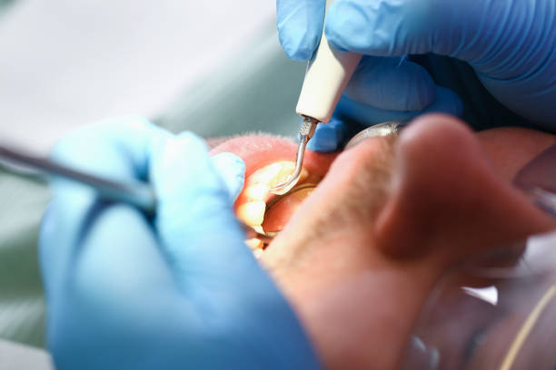 Best Dentist for Dental Trauma  in South Coventry, CT